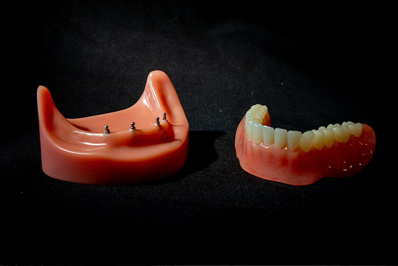 close up of denture models